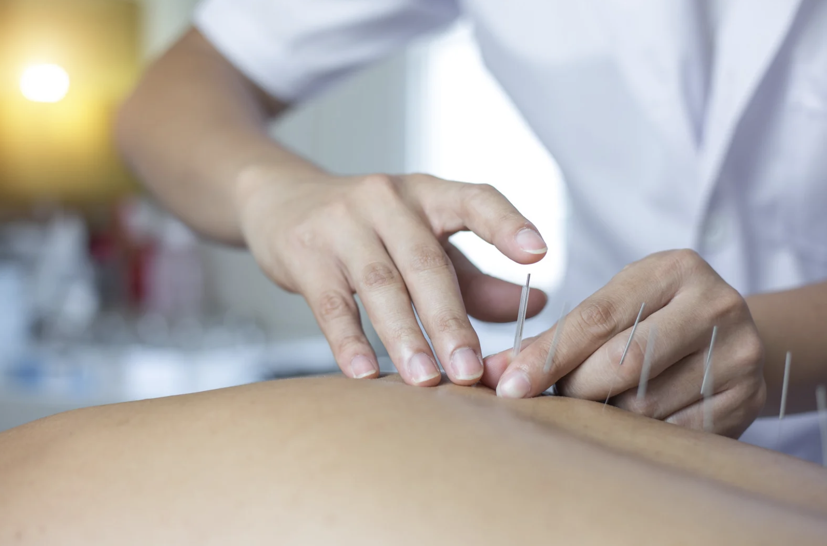 ご自宅やオフィスに出張、訪問、鍼治療